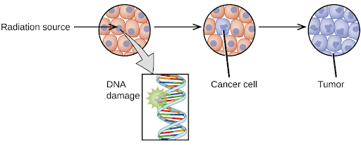 Radiation-Induced Tumor/ Cancer on Human Body