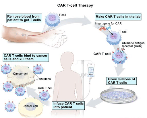 CAR-T cell therapy