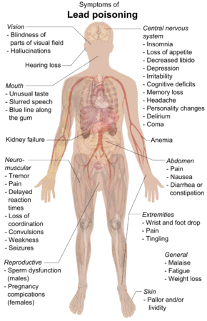 Lead Poisoning