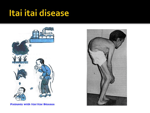 Itaiitai Disease Environment Notes